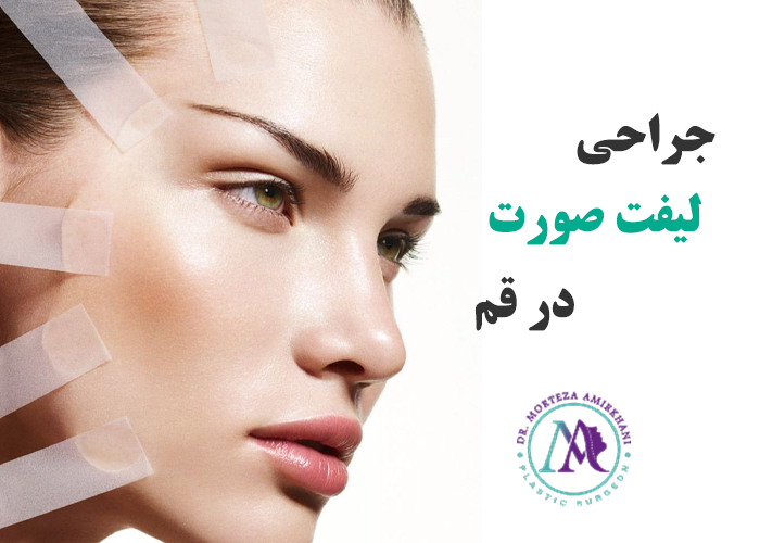 جراحی لیفت صورت در قم