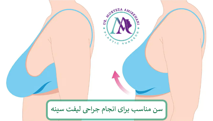 سن مناسب برای انجام جراحی لیفت سینه