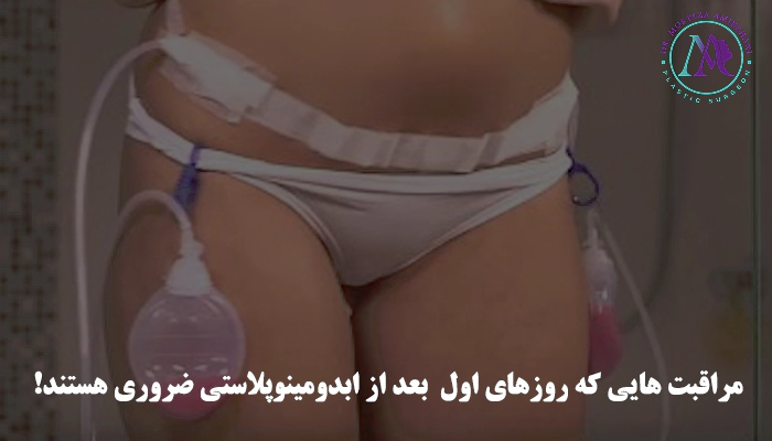 مراقبت های هفته اول بعد از ابدومینوپلاستی