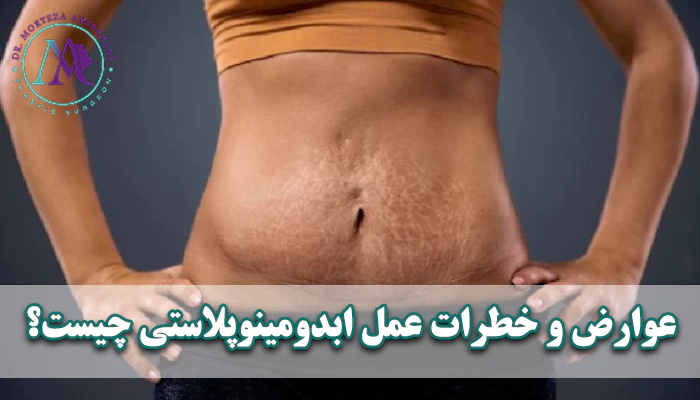 عوارض و خطرات عمل ابدومینوپلاستی چیست؟