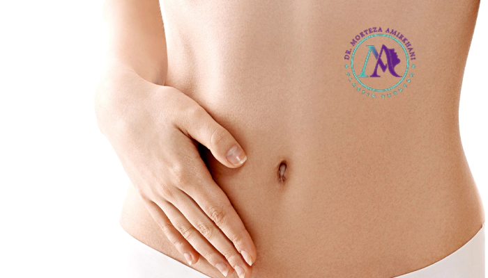چگونه میشود عوارض ابدومینوپلاستی را کاهش داد؟