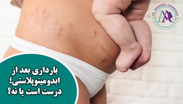 بارداری بعد از ابدومینوپلاستی درست است یا نه؟