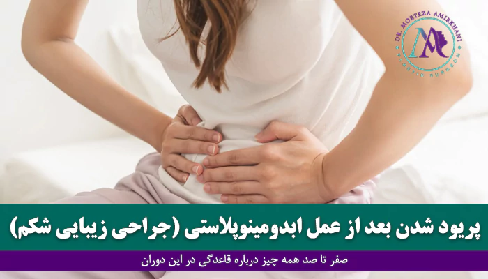 قاعدگی بعد از عمل ابدومینوپلاستی