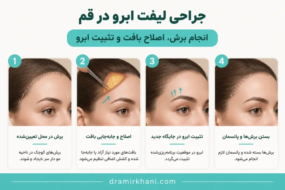 انجام برش، اصلاح بافت و تثبیت ابرو — نمای آموزشی از برنامهریزی برش و تثبیت ابرو در جراحی لیفت ابرو